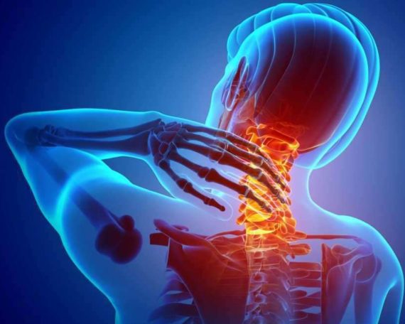 MSK-neck-pain-forward-head-posture-20210108-570x456-1